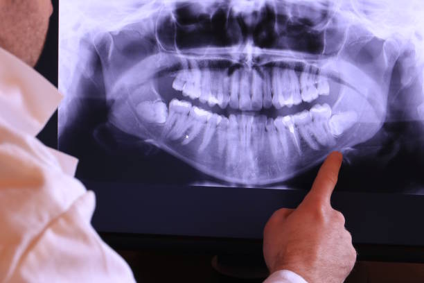 Best Emergency Denture Repair in Tryon, NC